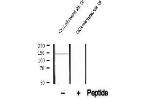 Western blot analysis of extracts of C2C12 cells treated with CIP, using Phospho-PTPα (Tyr798/789) Antibody.