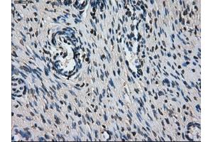 Immunohistochemical staining of paraffin-embedded colon tissue using anti-L1CAMmouse monoclonal antibody. (L1CAM antibody)