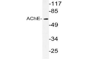 Western blot (WB) analyzes of AChE antibody in extracts from Jurkat cells. (Acetylcholinesterase antibody)