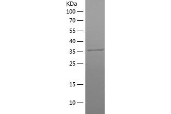 PGK1 Protein (AA 307-417) (His-IF2DI Tag)