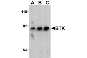 Western blot analysis of BTK in U937 cell lysate with AP30170PU-N BTK antibody at (A) 0. (BTK antibody  (N-Term))