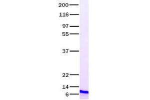 Validation with Western Blot (TGFA Protein (Transcript Variant 1))