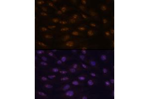 Immunofluorescence analysis of C6 cells using MyoD1 antibody  at dilution of 1:100. (MYOD1 antibody  (AA 150-250))