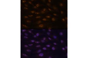 Immunofluorescence analysis of C6 cells using MyoD1 antibody  at dilution of 1:100. (MYOD1 antibody  (AA 150-250))