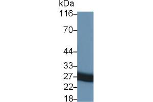 Detection of TIMP1 in Rat Seminal vesicle lysate using Monoclonal Antibody to Tissue Inhibitors Of Metalloproteinase 1 (TIMP1) (TIMP1 antibody  (AA 25-207))