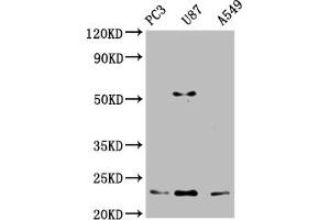 Western Blot Positive WB detected in: PC-3 whole cell lysate, U87 whole cell lysate, A549 whole cell lysate All lanes: FKBP11 antibody at 1:2000 Secondary Goat polyclonal to rabbit IgG at 1/50000 dilution Predicted band size: 23, 16 kDa Observed band size: 23 kDa