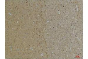 Immunohistochemical analysis of paraffin-embedded Rat BrainTissue using KCNK4 (TRAAK) Rabbit pAb diluted at 1:200. (KCNK4 antibody)