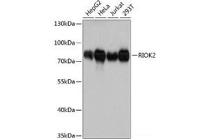 Western blot analysis of extracts of various cell lines using RIOK2 Polyclonal Antibody at dilution of 1:3000. (RIOK2 antibody)
