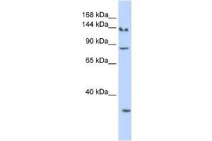 SIN3A antibody used at 0. (SIN3A antibody  (N-Term))