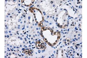 Immunohistochemical staining of paraffin-embedded Kidney tissue using anti-PPME1mouse monoclonal antibody. (PPME1 antibody)