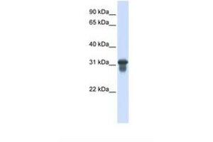 Image no. 1 for anti-Solute Carrier Family 25 (Mitochondrial Carrier, Oxoglutarate Carrier), Member 11 (SLC25A11) (C-Term) antibody (ABIN6738099) (SLC25A11 antibody  (C-Term))