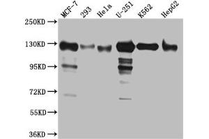 Western Blot Positive WB detected in: MCF-7 whole cell lysate, 293 whole cell lysate, Hela whole cell lysate, U-251 whole cell lysate, K562 whole cell lysate, HepG2 whole cell lysat All lanes: Eg5 Antibody at 1:1000 Secondary Goat polyclonal to rabbit IgG at 1/50000 dilution Predicted band size: 120 kDa Observed band size: 130 kDa (Recombinant KIF11 antibody)
