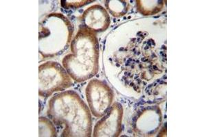 Immunohistochemistry analysis in formalin fixed and paraffin embedded human kidney tissue reacted with MBTPS2 Antibody (N-term) followed which  peroxidase conjugated to the secondary antibody and was followed by AB staining. (MBTPS2 antibody  (N-Term))