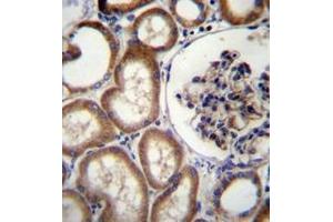 Immunohistochemistry analysis in formalin fixed and paraffin embedded human kidney tissue reacted with MBTPS2 Antibody (N-term) followed which  peroxidase conjugated to the secondary antibody and was followed by AB staining.