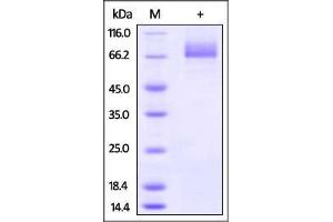 Influenza A [A/Hong Kong/483/97 (H5N1)] HA on SDS-PAGE under reducing (R) condition. (Hemagglutinin Protein (HA) (AA 17-531) (His tag))