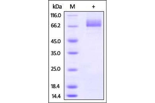 Hemagglutinin Protein (HA) (AA 17-531) (His tag)