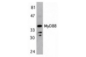 Western Blotting (WB) image for anti-Myeloid Differentiation Primary Response Gene (88) (MYD88) (Middle Region) antibody (ABIN1031006) (MYD88 antibody  (Middle Region))