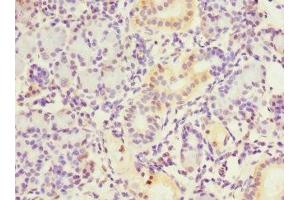 Immunohistochemistry of paraffin-embedded human pancreatic tissue using ABIN7149377 at dilution of 1:100 (NT5C3 antibody  (AA 37-336))