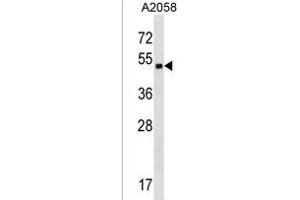 ZN Antibody (Center) (ABIN1538038 and ABIN2850129) western blot analysis in  cell line lysates (35 μg/lane). (ZNF559 antibody  (AA 196-224))