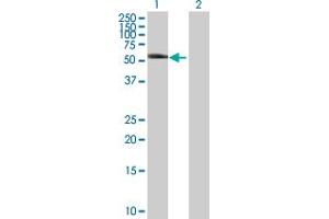 Western Blot analysis of KRT8 expression in transfected 293T cell line by KRT8 MaxPab polyclonal antibody. (KRT8 antibody  (AA 1-483))