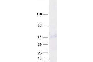 Western Blotting (WB) image for Wingless-Type MMTV Integration Site Family, Member 5A (WNT5A) protein (Myc-DYKDDDDK Tag) (ABIN2735621)