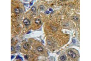 Used in DAB staining on fromalin fixed paraffin-embedded Liver tissue (Fibrinogen beta Chain antibody  (AA 29-118))