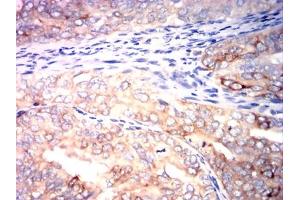 Immunohistochemistry (IHC) image for anti-Tumor Necrosis Factor Receptor Superfamily, Member 13B (TNFRSF13B) antibody (ABIN7193634)