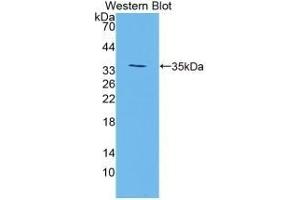 Detection of Recombinant TGM3, Mouse using Polyclonal Antibody to Transglutaminase 3, Epidermal (TGM3) (TGM3 antibody  (AA 468-693))
