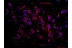 Immunofluorescence (IF) image for anti-RBP1-like protein (ARID4B) (AA 125-175) antibody (ABIN7448931) (BRCAA1 antibody  (AA 125-175))