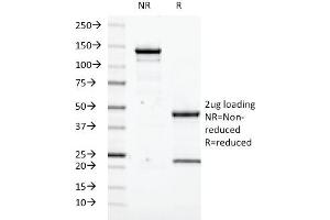 SDS-PAGE Analysis Purified Transglutaminase II Mouse Monoclonal Antibody (SPM358). (Transglutaminase 2 antibody)