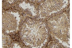 ABIN6276860 at 1/100 staining Mouse testis tissue by IHC-P. (CD1d antibody  (Internal Region))