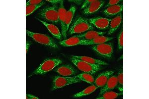 Immunofluorescence Analysis of MeOH-fixed HeLa cells labeled with CDw75 Mouse Monoclonal Antibody (LN-1) followed by goat anti-Mouse IgG-CF488 (Green).