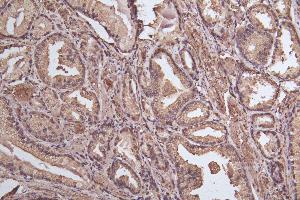Immunohistochemistry of paraffin-embedded human thyroid tissue using ABIN7164566 at dilution of 1:100 (ZDHHC12 antibody  (AA 121-197))