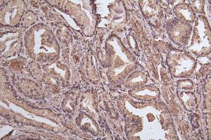 Immunohistochemistry of paraffin-embedded human thyroid tissue using ABIN7164566 at dilution of 1:100