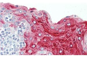 Detection of ECM1 in Human Tonsil Tissue using Polyclonal Antibody to Extracellular Matrix Protein 1 (ECM1) (ECM1 antibody  (AA 20-434))