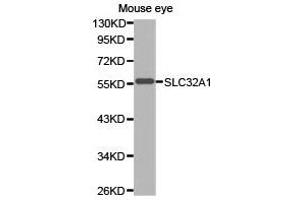 Western Blotting (WB) image for anti-Solute Carrier Family 32 (GABA Vesicular Transporter), Member 1 (SLC32A1) antibody (ABIN1874828)