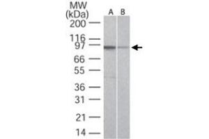 Western blot analysis of TLR5 in A) Ramos and B) Raw cell lysate using TLR5 monoclonal antibody, clone 19D759. (TLR5 antibody  (AA 700-800))