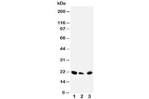 Western blot testing of DUSP3 antibody and Lane 1:  rat testis (Dual Specificity Phosphatase 3 (DUSP3) (C-Term) antibody)
