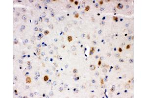 Anti-Aryl hydrocarbon Receptor antibody,  IHC(P) IHC(P): Mouse Brain Tissue (Aryl Hydrocarbon Receptor antibody  (C-Term))
