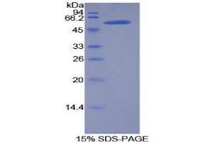 SDS-PAGE (SDS) image for Kallikrein 6 (KLK6) (AA 26-261) protein (His tag,GST tag) (ABIN2123098) (Kallikrein 6 Protein (KLK6) (AA 26-261) (His tag,GST tag))