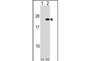 Western blot analysis of IP2 (arrow) using rabbit polyclonal IP2 Antibody (N-term) (ABIN1539498 and ABIN2848464). (PAIP2 antibody  (N-Term))