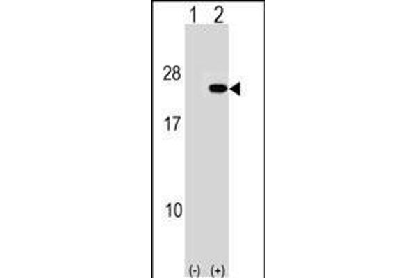 PAIP2 Antikörper  (N-Term)
