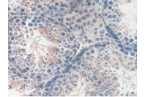 Figure. (LAMP2 antibody  (AA 295-410))