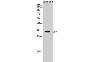 Western Blotting (WB) image for anti-P57 (N-Term) antibody (ABIN3180791) (P57 (N-Term) antibody)