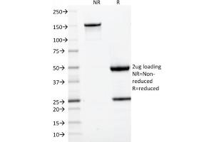 SDS-PAGE Analysis Purified CD22-Monospecific Mouse Monoclonal Antibody (BLCAM/1795). (CD22 antibody  (AA 52-178))