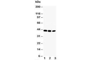 Western blot testing of CCR6 antibody and Lane 1:  rat liver;  2: SW620;  3: CEM cell lysate (CCR6 antibody  (C-Term))