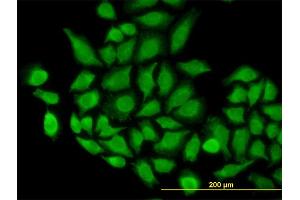 Immunofluorescence (IF) image for anti-Translocase of Outer Mitochondrial Membrane 22 Homolog (TOMM22) (AA 1-142) antibody (ABIN566068)