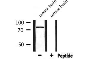 Western blot analysis of extracts from mouse brain, using TICAM1  Antibody. (TICAM1 antibody  (Internal Region))
