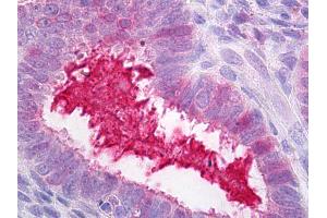 Immunohistochemistry (IHC) image for anti-Serpin Peptidase Inhibitor, Clade G (C1 Inhibitor), Member 1 (SERPING1) antibody (ABIN1502156)