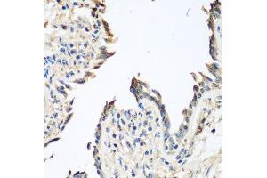 Immunohistochemistry of paraffin-embedded human lung using GPI antibody. (GPI antibody  (AA 1-280))